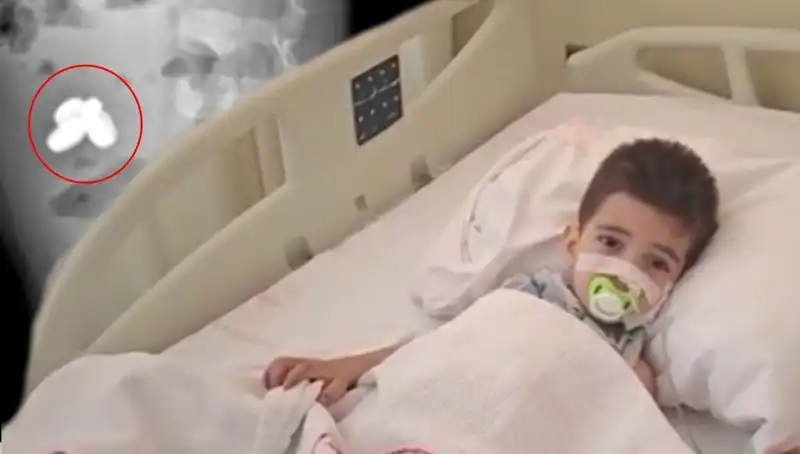 Küçük Çocuğun Hayatını Tehdit Eden Olay: Pil ve Mıknatıs Yutma Krizi