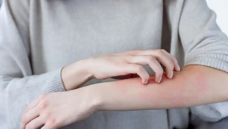 Cilt Kanserinin Görmezden Gelinen İki Belirtileri: Dermatologdan Kritik Uyarılar
