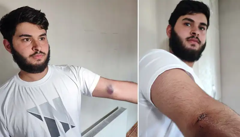 Bahçeye Kaçan Top, Mahallede Neden Büyük Bir Karmaşa Yarattı?